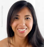 Restylane injections 