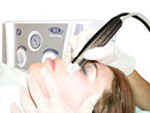 Microdermabrasion machine