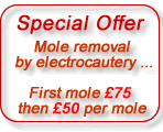 Mole removal offer